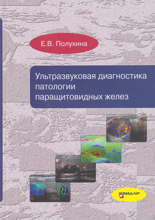 Ультразвуковая диагностика патологии паращитовидных желез - Е.В. Полухина (978-5-88429-253-6)
Ультразвуковая диагностика патологии паращитовидных желез - Е.В. Полухина (978-5-88429-253-6)