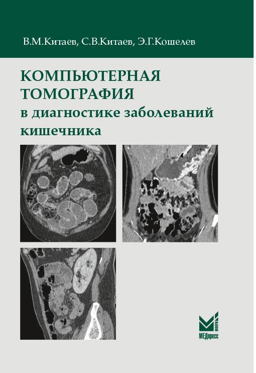 Китаев В.М., Китаев С.В., Кошелев Э.Г. Компьютерная томография в диагностике заболеваний кишечника 2020 год (978-5-00030-734-2) Изд. МЕДпресс-информ
Китаев В.М., Китаев С.В., Кошелев Э.Г. Компьютерная томография в диагностике заболеваний кишечника 2020 год (978-5-00030-734-2) Изд. МЕДпресс-информ