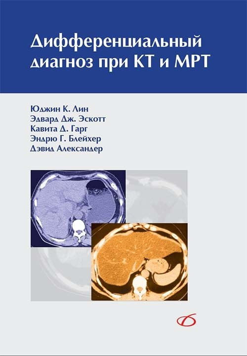 Лин Юджин К. Дифференциальный диагноз при КТ и МРТ (978-5-91803-008-0) Изд. Медицинская литература
Лин Юджин К. Дифференциальный диагноз при КТ и МРТ (978-5-91803-008-0) Изд. Медицинская литература