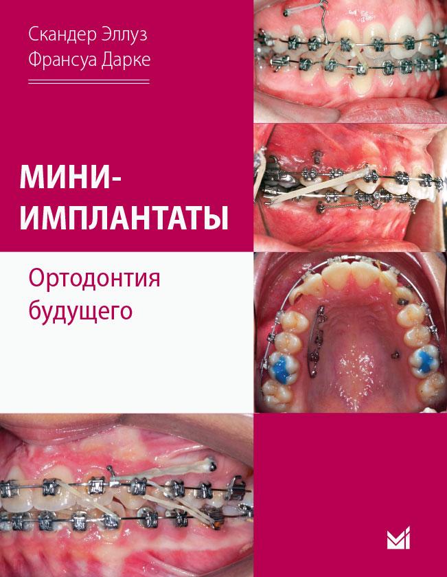 Мини-имплантаты. Ортодонтия будущего. Скандер Эллуз, Франсуа Дарке. 2021 г. (978-5-00030-807-3) Изд. МЕДпресс-информ
Мини-имплантаты. Ортодонтия будущего. Скандер Эллуз, Франсуа Дарке. 2021 г. (978-5-00030-807-3) Изд. МЕДпресс-информ