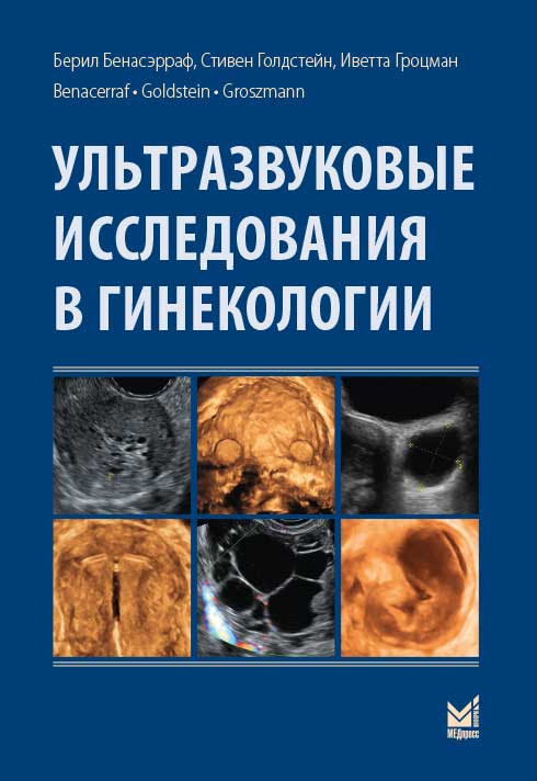Бенасэрраф Б. Ультразвуковые исследования в гинекологии 2016 год (978-5-00030-785-4) Изд. МЕДпресс-информ
Бенасэрраф Б. Ультразвуковые исследования в гинекологии 2016 год (978-5-00030-785-4) Изд. МЕДпресс-информ