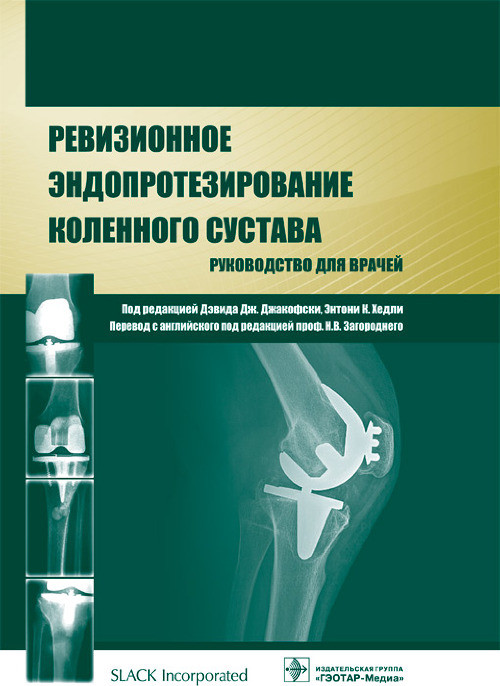 Джакофски Д.Дж., Хедли К.Э. Ревизионное эндопротезирование коленного сустава. 2015 год (978-5-9704-3186-3) Изд. ГЭОТАР-Медиа
Джакофски Д.Дж., Хедли К.Э. Ревизионное эндопротезирование коленного сустава. 2015 год (978-5-9704-3186-3) Изд. ГЭОТАР-Медиа
