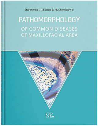 Pathomorphology of Сommon Diseases of Maxillofacial Area Патоморфологія основних захворювань щелепно-лицевої ділянки. Старченко І.І., Филенко Б.М., Черняк В.В.
Pathomorphology of Сommon Diseases of Maxillofacial Area Патоморфологія основних захворювань щелепно-лицевої ділянки. Старченко І.І., Филенко Б.М., Черняк В.В.