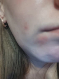 Набор La Roche-Posay Effaclar для проблемной кожи лица (5902503198114) фото от покупателей 1