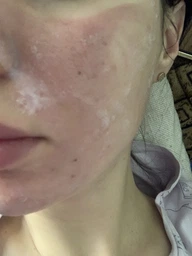 Салицилово-резорциновый пилинг Home-Peel рН 2.5 10 мл (4820208890090)