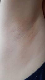 Фотоэпилятор PHILIPS Lumea Prestige BRI956/00 фото от покупателей 8