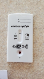 Экспресс-тест ECOTEST COV-W23M для выявления COVID-19, антитела IgG/IgM №1 фото от покупателей 15