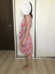Платье-рубашка короткое летнее женское Colin's CL1048955CRL XS фото от покупателей 3
