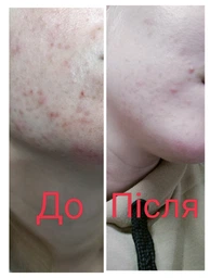 Гель-мусс La Roche-Posay Effaclar+ M для очищения проблемной кожи 400 мл (3337872411991) фото от покупателей 13
