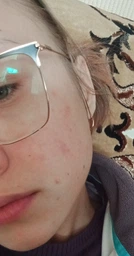 Сыворотка с ретинолом 0.5% омолаживающая CUSKIN Clean-Up Retinol Activator 0.5% 30 мл фото от покупателей 1