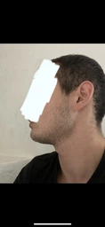 Міноксидил Folixidil Beard Booster 16% для росту волосся та бороди 60 мл фото від покупців 2