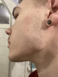 Міноксидил 5% Minoxidil KIRKLAND для росту волосся та бороди ( 60 мл ) фото від покупців 1