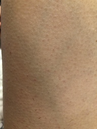 Эпилятор BRAUN Silk epil 9 SES 9/720 SensoSmart фото от покупателей 2