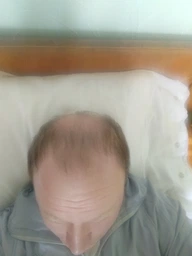 Шампунь для роста волос Hillary Hop Cones & B5 Hair Growth Invigorating 250 мл 2314947241203
