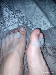 Силіконовий коректор-роздільник для пальців ніг Clefers ToeSep 35- Лікування кісточки (500448) 1 пара фото від покупців 2