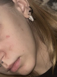Гель-крем тройного действия La Roche-Posay Effaclar Duo+M для Коррекции недостатков проблемной кожи и Предотвращения их повторного появления 40 мл (3337875863377) фото от покупателей 3