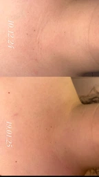 Пептидный крем для шеи и декольте MEDI-PEEL Naite Thread Neck Cream 100 мл