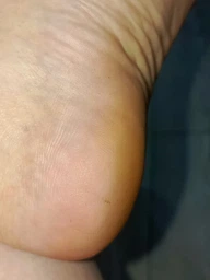 Пемза пилка для ніг та п'яток роликова аккумуляторна Callus Remover 3W електрична для шліфування електропемза для педикюру USB рожева фото від покупців 2
