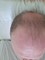 Шампунь Garnier Fructis Рост во всю силу для ослабленных волос склонных к выпадению 400 мл (3600541775855)