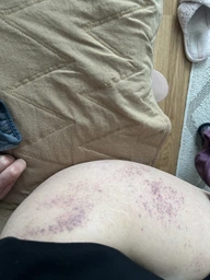 Массажер вакуумный 6 режимов Cupping Massage Pro аккумуляторный + масло 1 шт зеленый фото от покупателей 8