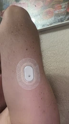 Сенсор Sibionics CGM — система непрерывного мониторинга уровня глюкозы 24/7.