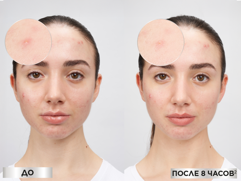 Responsive Image