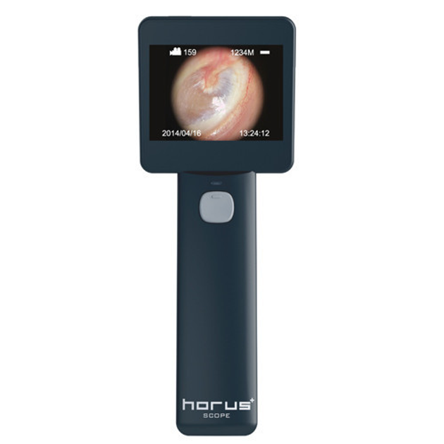 Отоскоп цифровой Medimaging Integrated Solution MIIS EOC100 Horus Digital Otoscope Full HD для диагностики слухового канала - изображение 1