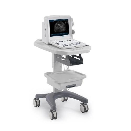Ультразвуковая диагностическая система Edan U50 Prime Edition - зображення 2