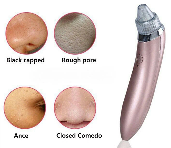 Вакуумный аппарат для чистки пор лица XN-8030 Pink (kz048) - изображение 7