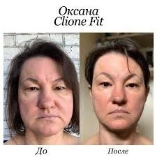 Японский аппарат 5 в 1 с передовыми технологиями для лица Clione Fit - изображение 7