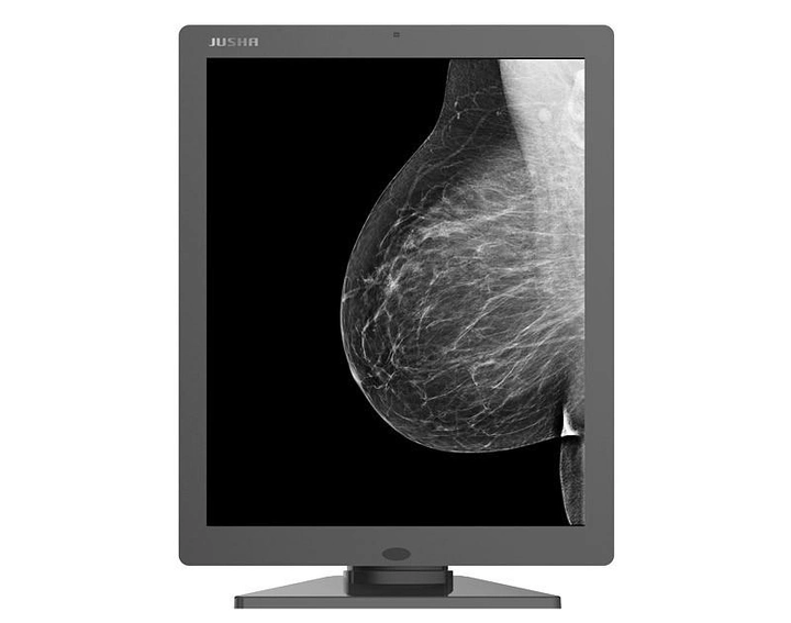 Мамографічний медичний монітор JUSHA-M53 (5МП, монохромний, діагональ 21,3 дюйми, для рентгенографії, мамографії, МРТ, КТ, ангіографії) - зображення 2
