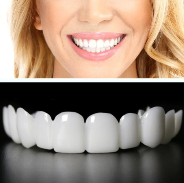 Съемные пластиковые виниры для зубов Veneers Snap On для быстрой временной реставрации зубов на оду челюсть + бокс для хранения - изображение 3