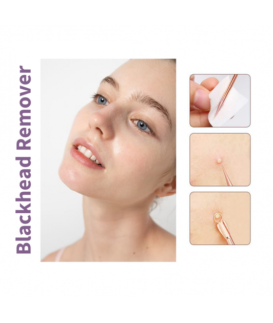 Набор для чистки лица Moday Blackhead Remover — инструменты для удаления угрей комедонов и черных точек двусторонние косметологические петли 4 инструмента 8 насадок - Фото 4 Набор для чистки лица Moday Blackhead Remover — инструменты для удаления угрей комедонов и черных точек двусторонние косметологические петли 4 инструмента 8 насадок - изображение 4