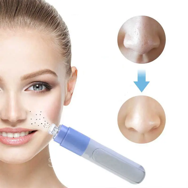 Вакуумный очиститель пор от угрей Face spot - изображение 2
