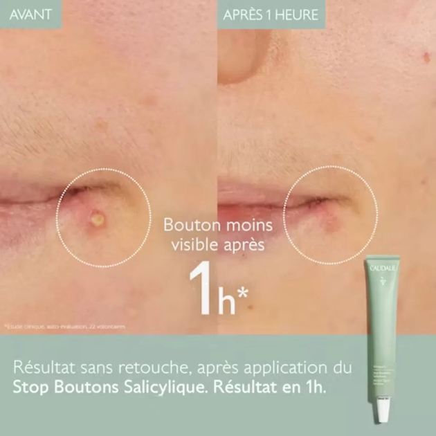 Krem punktowy przeciw niedoskonałościom skóry Caudalie Vinopure Salicylic Spot Solution do cery tłustej i mieszanej trądzikowej 15 ml (3522930004073) - obraz 4