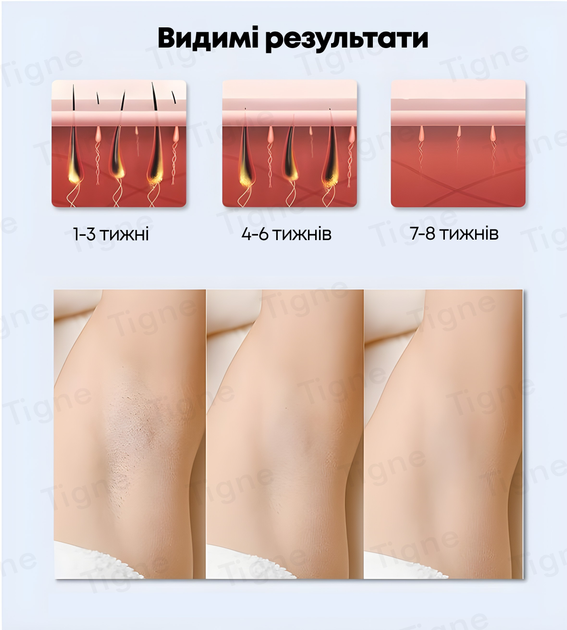 Фотоэпилятор IPL со съемными насадками LESCOLTON T107 - изображение 10
