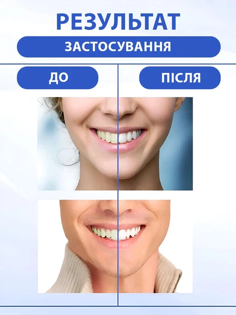 Відбілюючі смужки для зубів 5D White засіб відбілювання зубів від зубного нальоту набір 14 пар / 28 шт смужок (0096-0002) - зображення 2