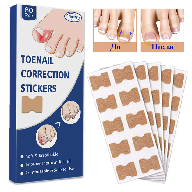 Пластир для корекції врослого нігтя Toenail Correction Sticker 60 шт - зображення 1