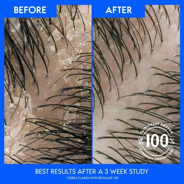 Шампунь від лупи Head & Shoulders Menthol 500 мл (8700216158114) - зображення 3