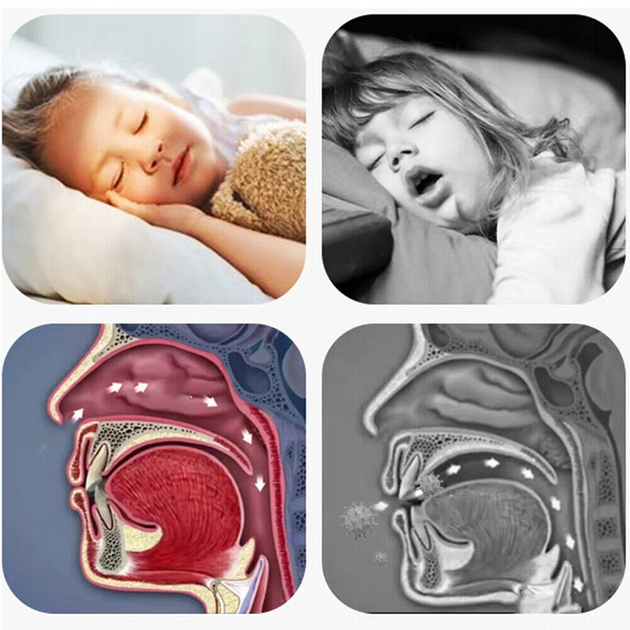 Смужки для забезпечення носового дихання уві сні Kids Sleep Strips 30 шт Дитячі Large РК012 - зображення 2