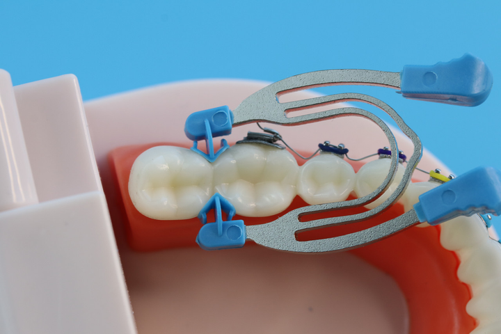 Стоматологические кольца для адаптации матрицы (аналог палодент) - зображення 2