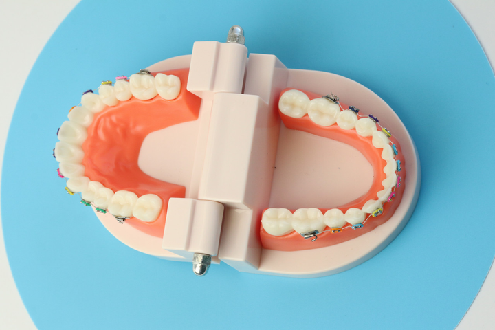 Демонстрационная модель челюсти с брекетами - зображення 2