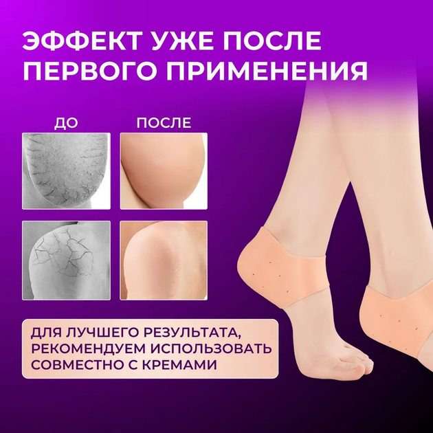 Силиконовая защита для пяток Heel Anti-Crack Sets Носочки на пятки накладка от мозолей - изображение 5