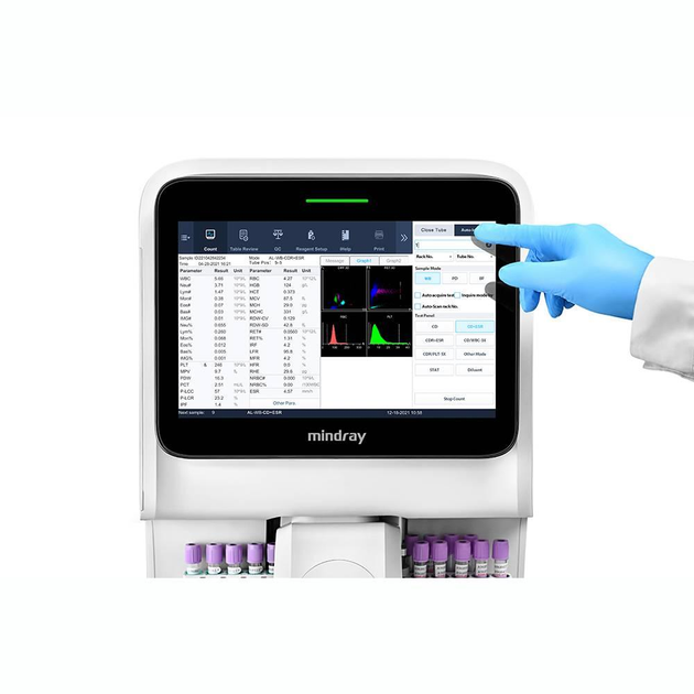 Автоматичний гематологічний аналізатор з аналізом ШОЕ та автоматичною подачею зразка MINDRAY ВС-760 (ВС-760) - зображення 2