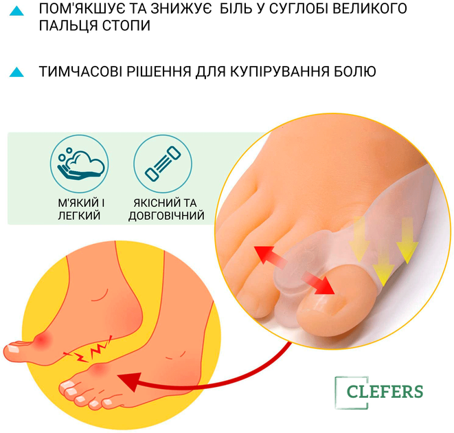 Подвійний гелевий фіксатор для корекції великого пальця стопи Clefers FK-7700 (570649) 1 пара - Фото 7 Подвійний гелевий фіксатор для корекції великого пальця стопи Clefers FK-7700 (570649) 1 пара - зображення 7