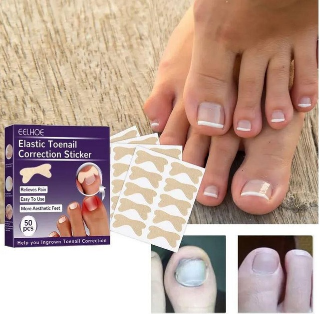 Набір пластирів Elastic Toenail Correction Sticker (50 pcs) для корекції нігтів, що вростають (ECS1000) - зображення 2