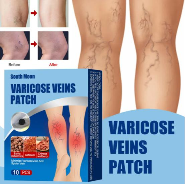 Пластырь от варикоза набор 10 штук Varicose Veins Patch на растительных компонентах для ног, от отеков - изображение 1