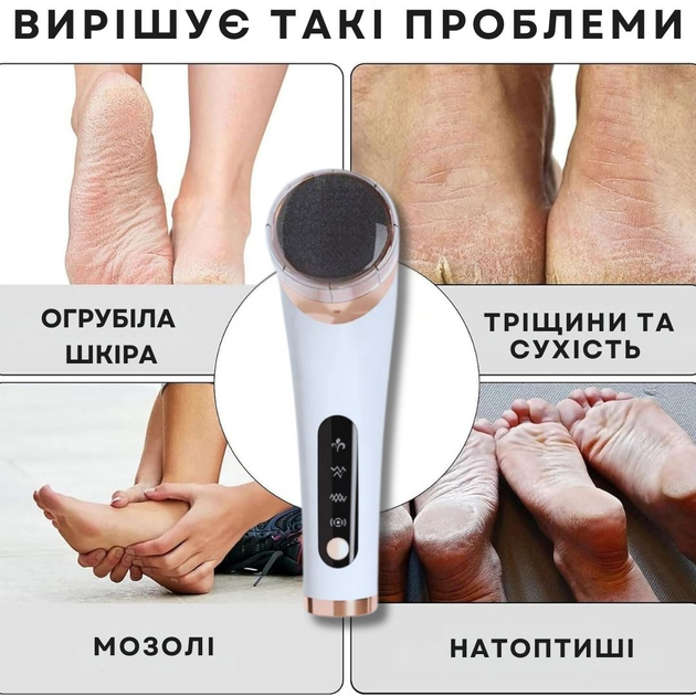 Электрическая роликовая пилка-пемза AIMED Foot Master Round белый - изображение 7