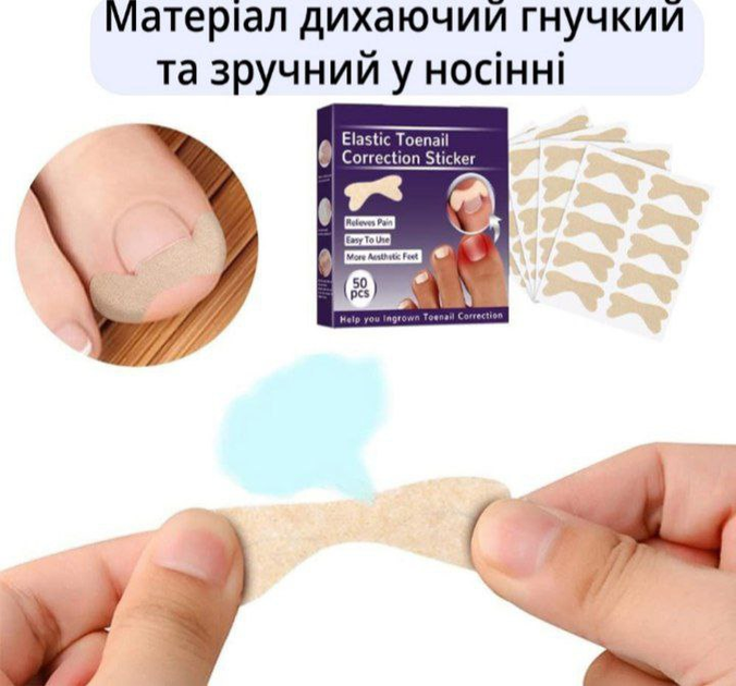 Набір пластирів Elastic Toenail Correction Sticker для корекції та усунення врослих нігтів (50 шт.) - зображення 1