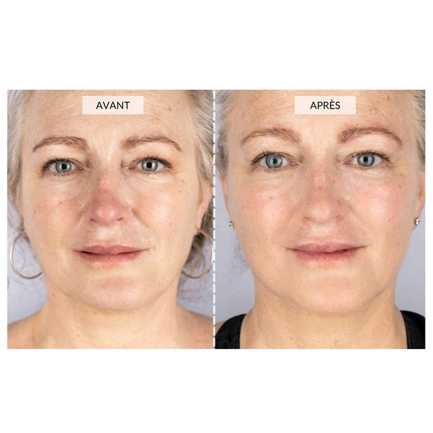 Набор CurrentBody Skin LED Light Therapy Face Neck Kit для лица, шеи и зоны декольте - изображение 5